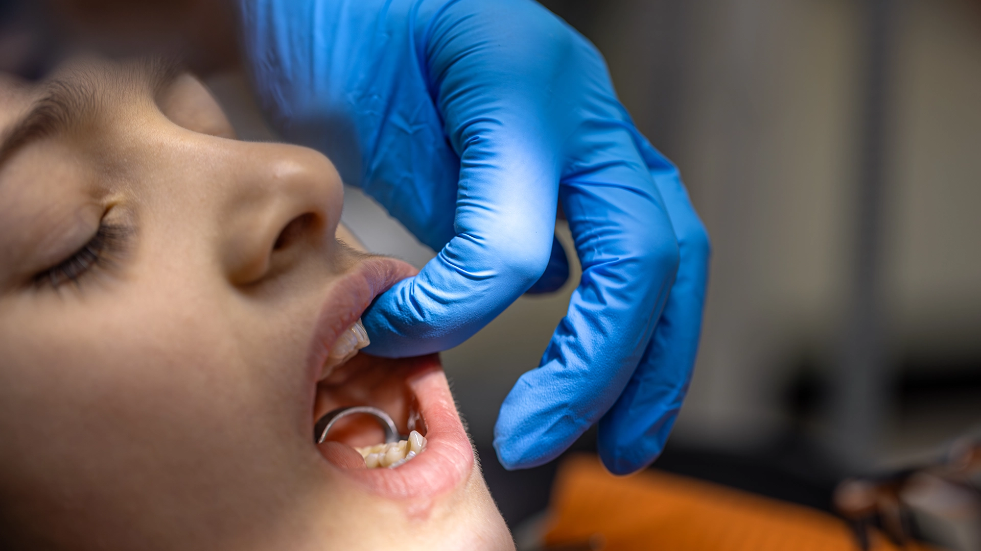 Médico examinando a boca de um paciente para diagnóstico de câncer bucal